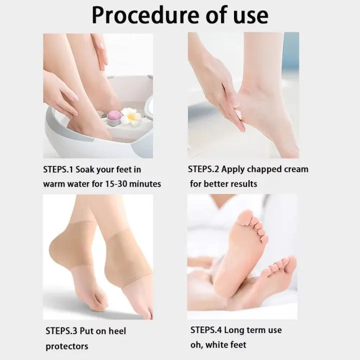 Silicone Gel Heel Protector Socks – Anti-Crack, Moisturizing Half Socks