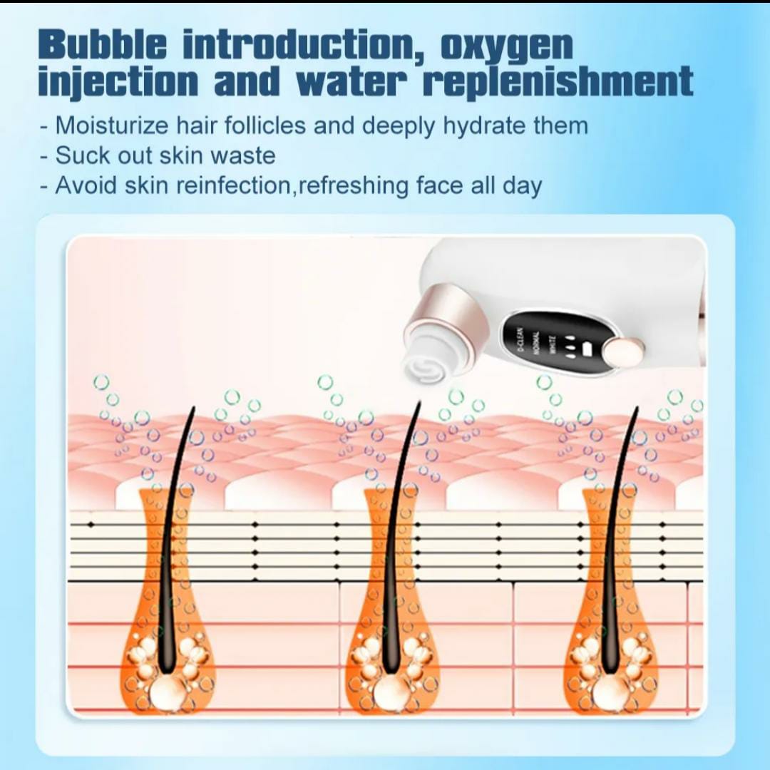 Dermaclear Super Micro Bubble Facial Vacuum & Blackhead Remover